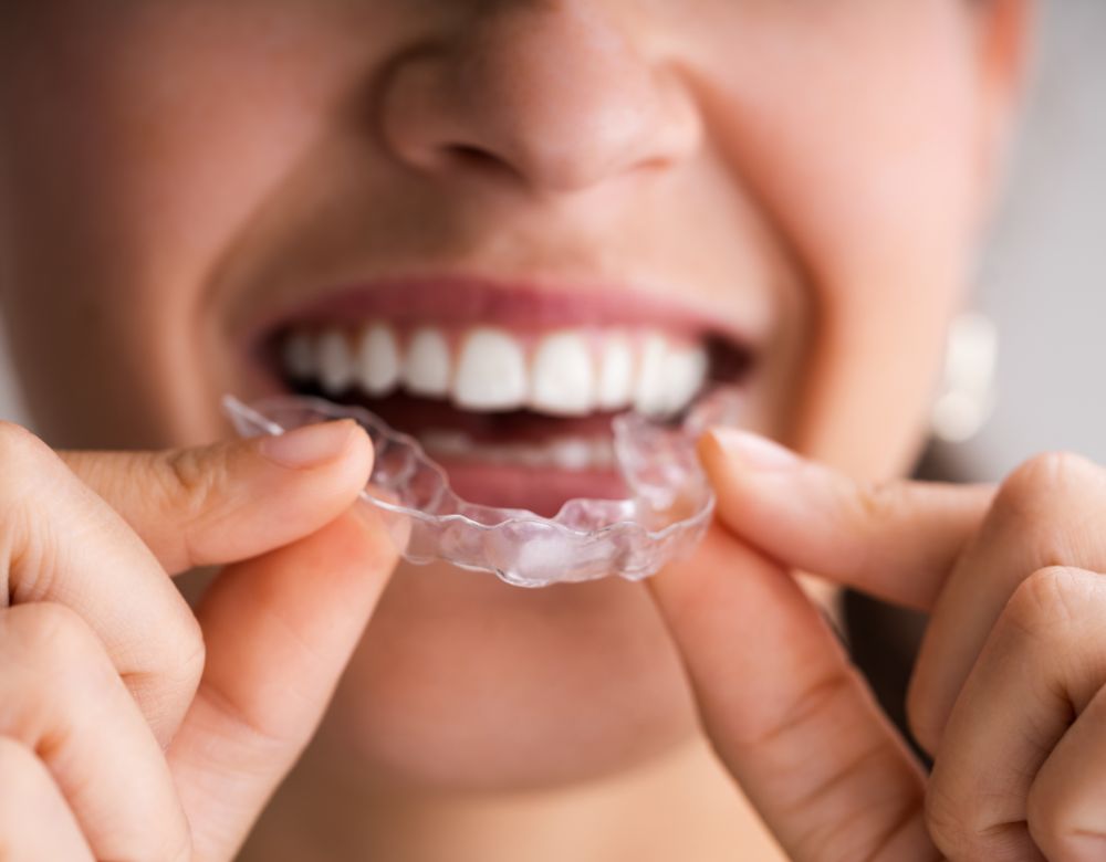 Bruxism Treatment in Calgary NE, Rundle, Whitehorn and Marlborough