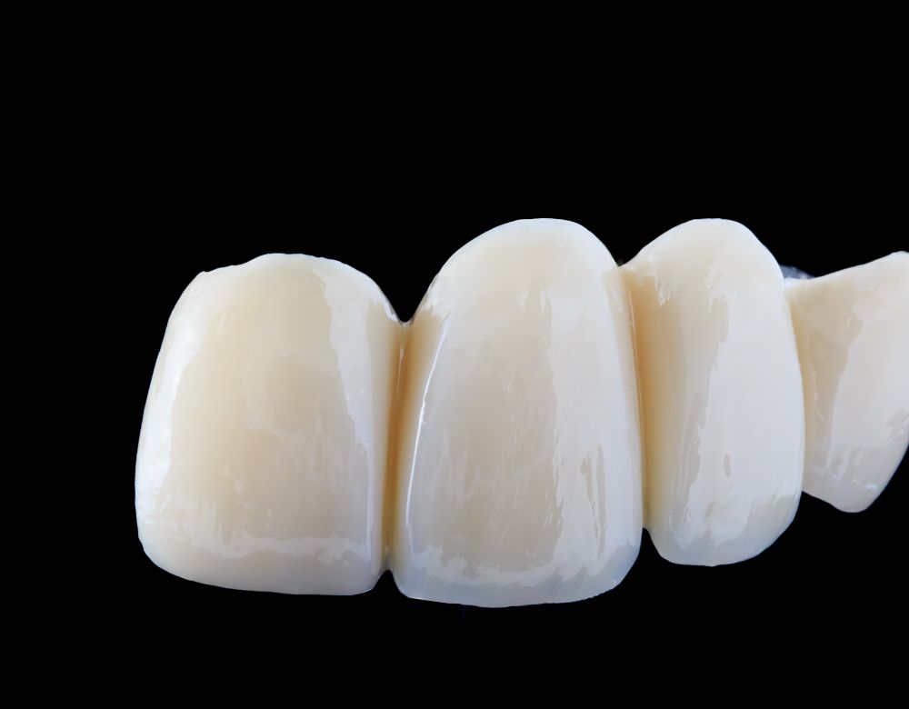 DENTAL BRIDGES 1